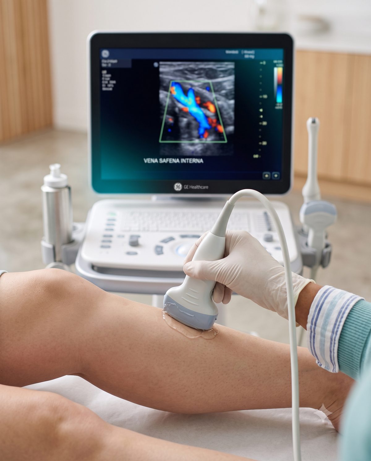 Laboratório vascular próprio da Clínica Moss — Duplex Scan / EcoDoppler